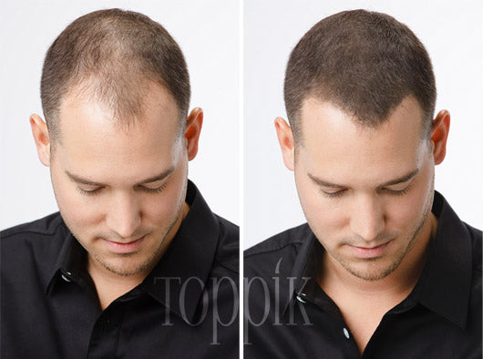 Toppik DUO – edullinen valinta